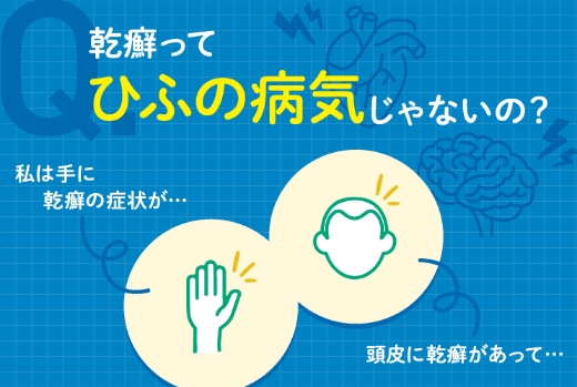 「乾癬ってひふの病気じゃないの？」バナー