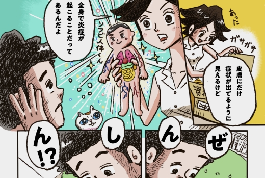 Top find your psoriasis treatment with aya banner