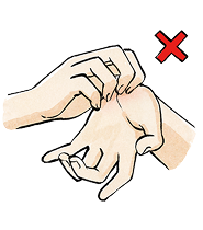 イラスト_皮膚症状を掻き壊さないようにしましょう