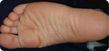 写真_歯性病巣感染治療の治療後